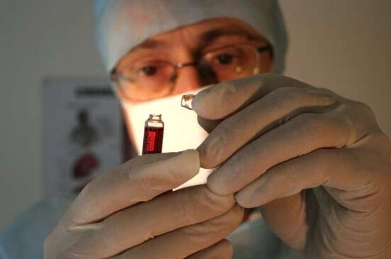 Sedef hastalığının nedenleri Doktor
